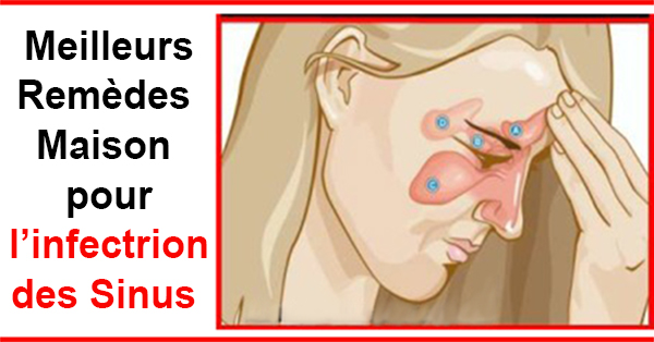 Comment Se Débarrasser De Linfection Des Sinus