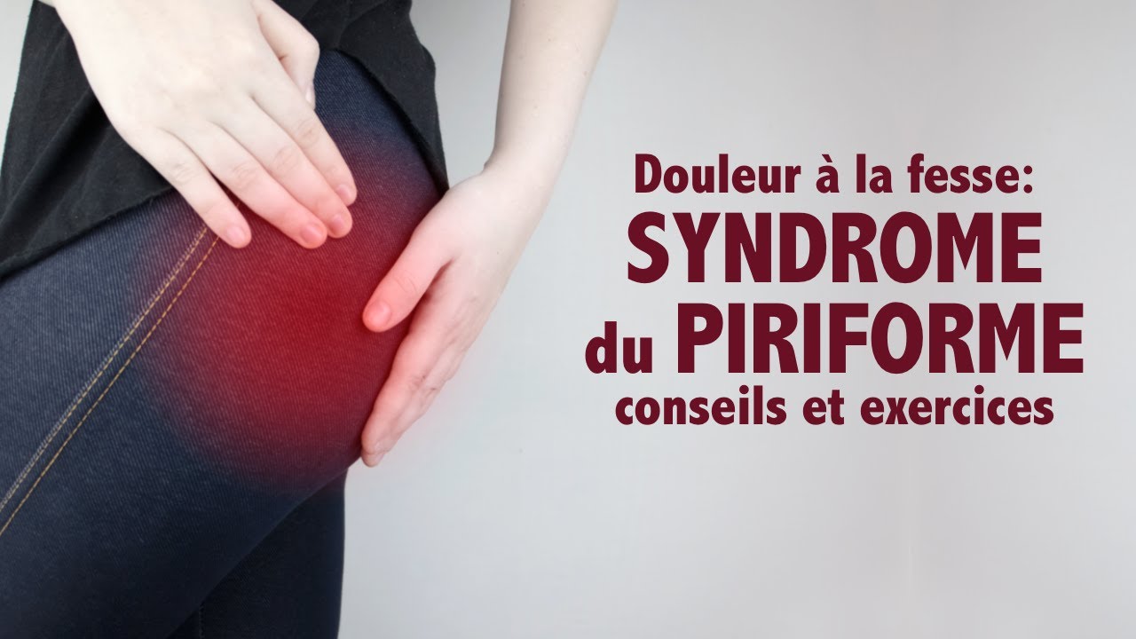 Douleur à la fesse et syndrome du piriforme exercices et conseils