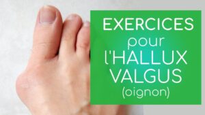 Hallux valgus: exercices et infos