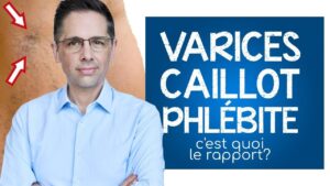 Varices, caillot et phlébite: c'est quoi le rapport ?