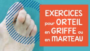 Orteil en griffe ou en marteau: infos, conseils et exercices efficaces (déformations aux pieds)