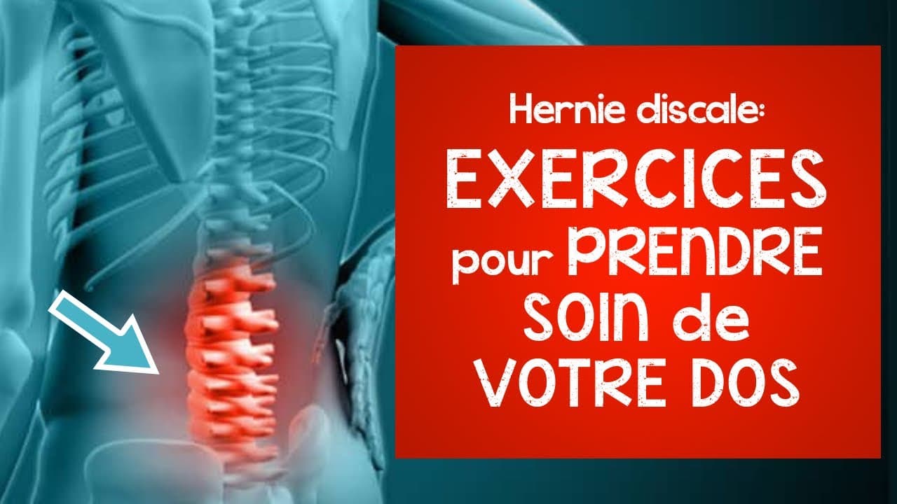 Hernie Discale Exercices Pour Prendre Soin De Votre Dos Des Conseils Pratiques