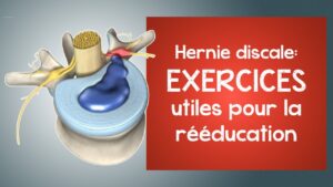 Hernie discale : des exercices utiles pour la rééducation