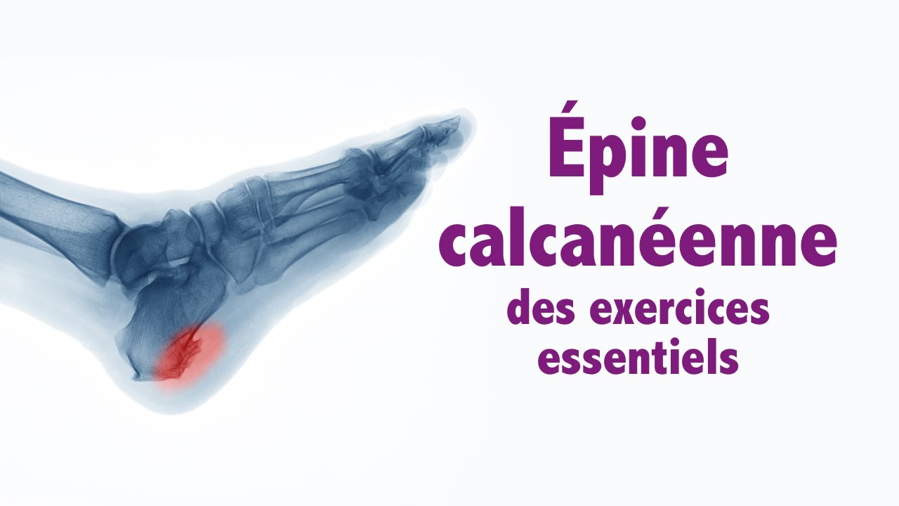 Épine calcanéenne (de Lenoir) des exercices essentiels, niveau