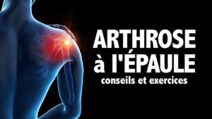 Arthrose à l'épaule: conseils et exercices