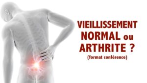 Raideur au dos: vieillissement normal ou arthrite ? (format conférence)