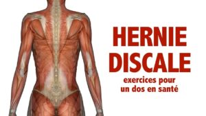 Hernie discale : exercices pour la santé du dos