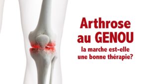 Arthrose au genou: la marche est elle vraiment une bonne option?
