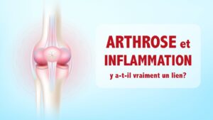 Arthrose et inflammation: y a-t-il VRAIMENT un lien?