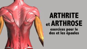 Arthrite et arthrose: exercices pour le dos et les épaules (niv. avancé)
