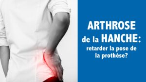 ARTHROSE de la HANCHE: comment retarder la pose de la prothèse?