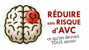 AVC: comment RÉDUIRE son risque d'en faire un!