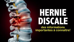 Hernie discale: des informations importantes à connaître!