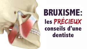 Bruxisme : les précieux conseils d'une dentiste!