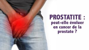 Prostatite : peut-elle évoluer en cancer de la prostate ?